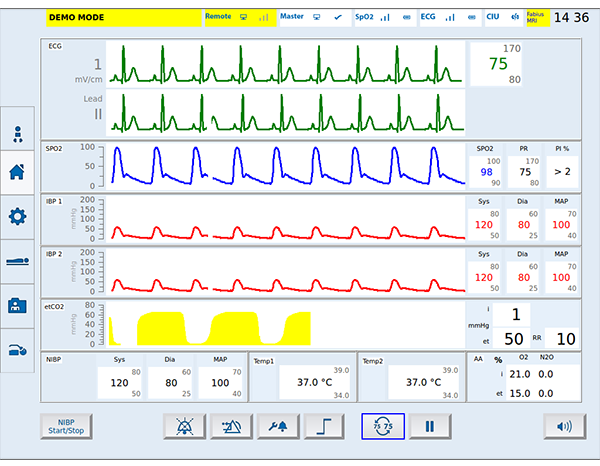 有注册证核磁监护仪 有注册证核磁监护仪